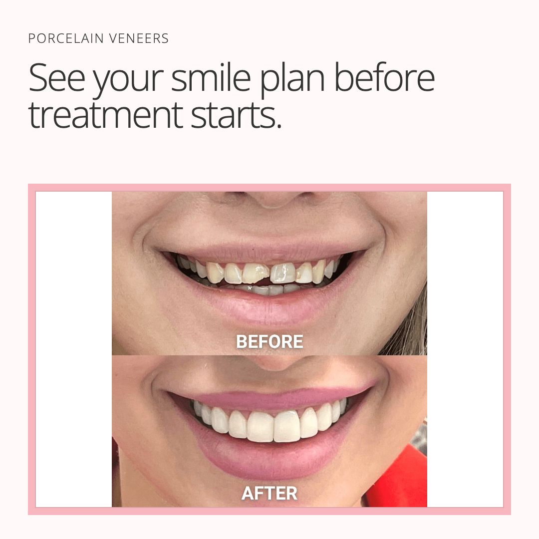 First finished Adelaide Cosmetic Dentistry image ad