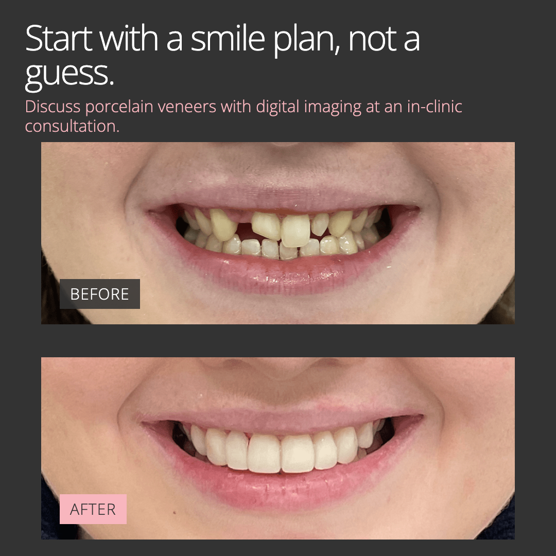 Second finished Adelaide Cosmetic Dentistry image ad